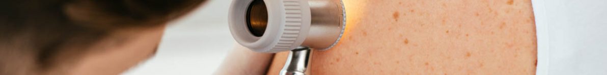 cropped view of dermatologist in latex gloves holding dermatosco